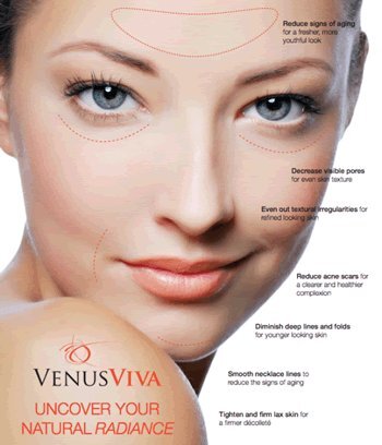 venus-viva-img1