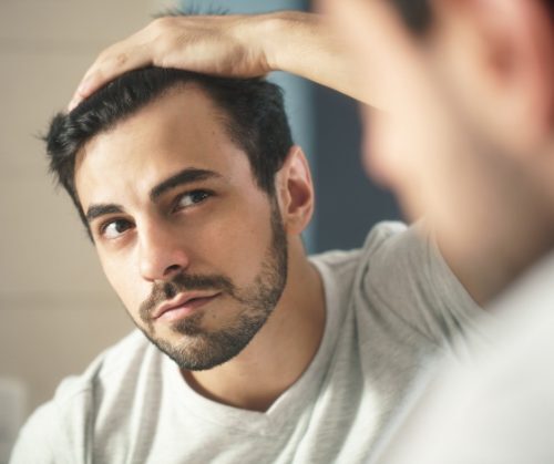 man-worried-for-alopecia-checking-hair-for-loss-picture-id980122572