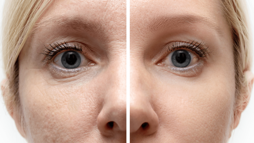Chemical Peel A&B