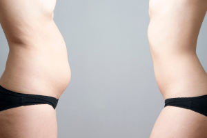 SmartLipo the Shape Changer