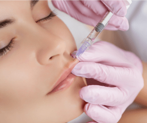 Botox lip flip