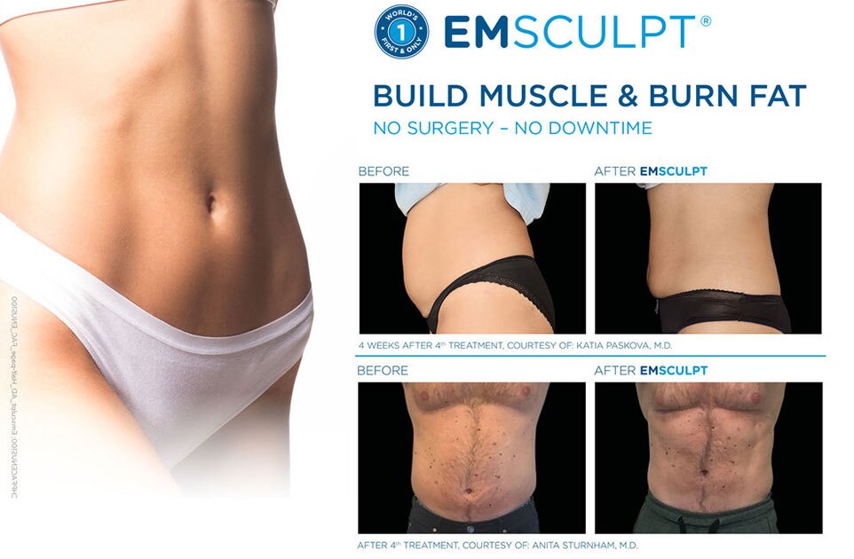 Emsculpt-The-Woodlands