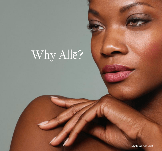Juvederm double points- Vedas Medical Spa & Wellness Center