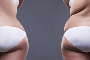 complimentary consultation