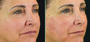 Skin Scaffolding