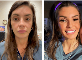 youthful cheek profile balancing