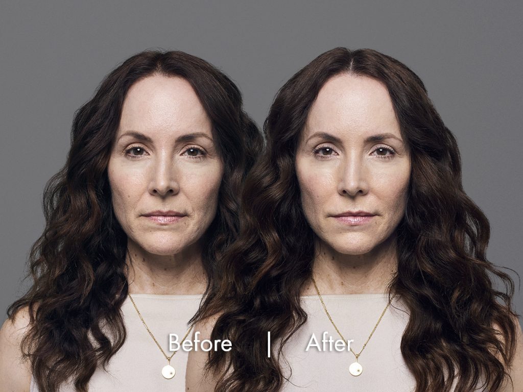 natural fillers