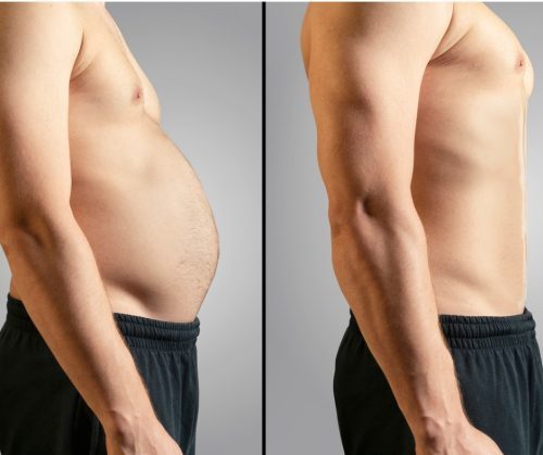 Example of body contouring 