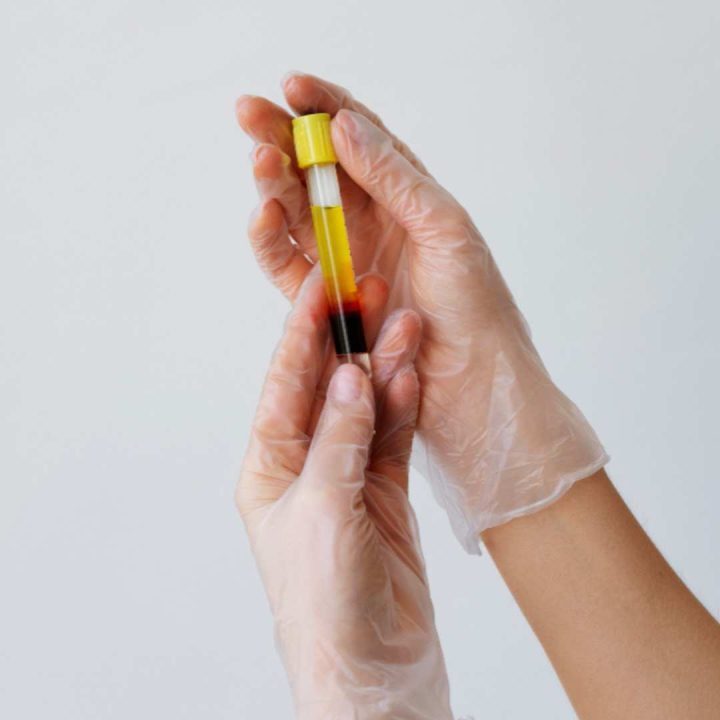 Combination Treatments