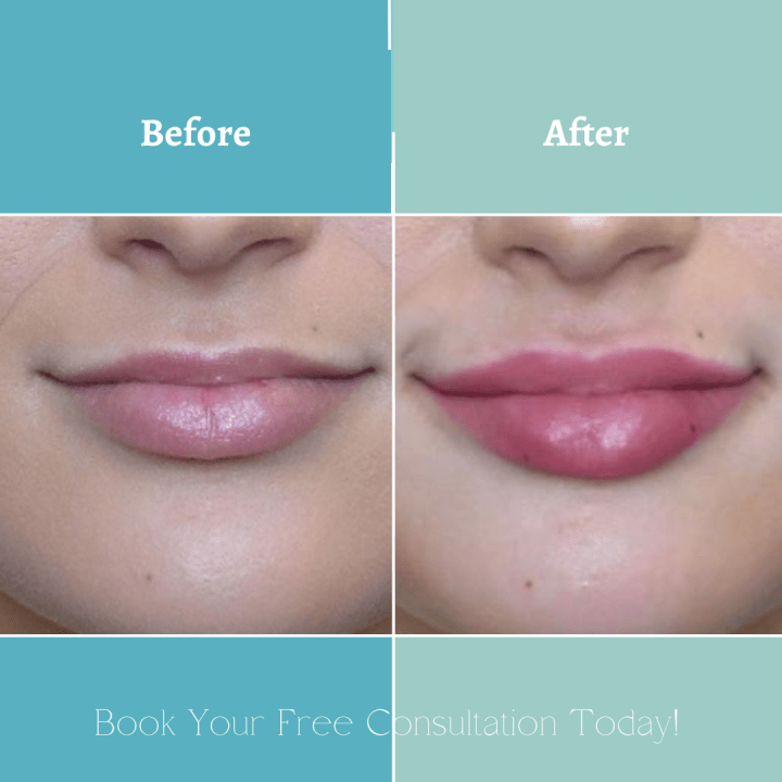 Lips A&B