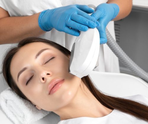 elos-epilation-hair-removal-procedure-on-the-face-of-a-woman-doing-picture-id1299773436