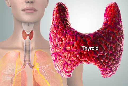 thyroid disease The Thyroid is a butterfly-shaped gland in the front of the neck